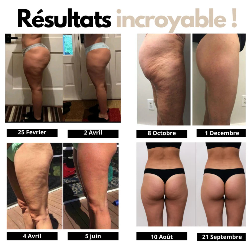 Legging 3D Anti-Cellulite